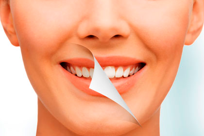 Estética dental