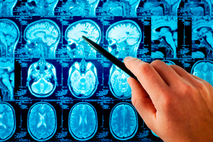 Neurologí­a