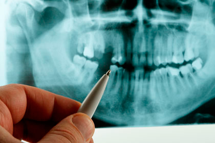 T.A.C. dental